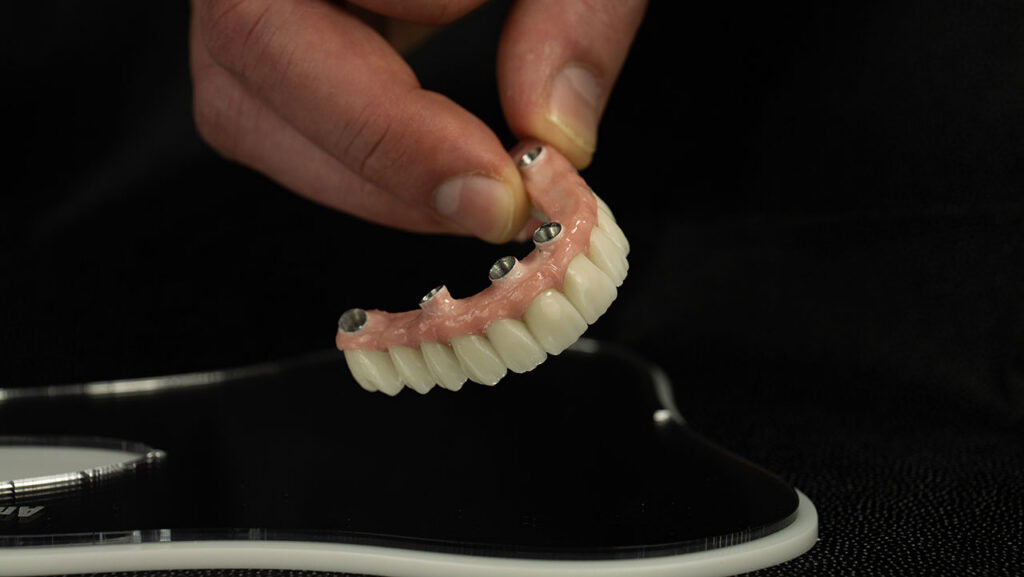 Snap-in Dentures in Annapolis, How They Work and Why They Are a Stable Solution